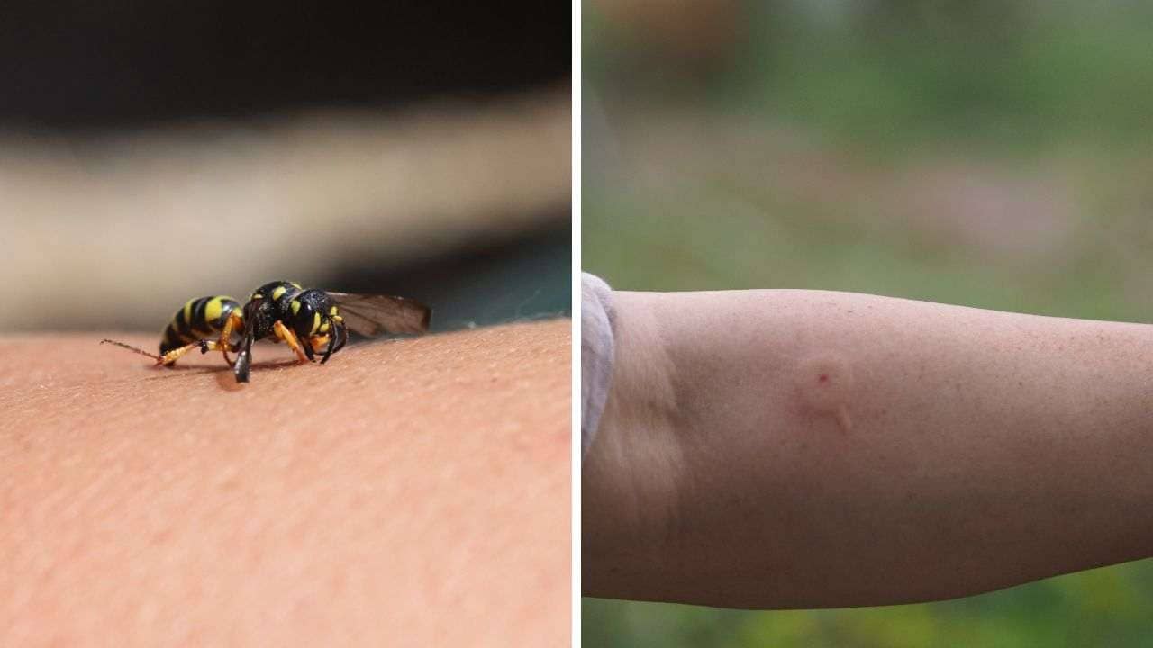 Emergency first aid for bee: বোলতা কামড়ালে ভুলেও করবেন না এই কাজ! জ্বালা কমাতে ১ মিনিটের মধ্যে করে ফেলুন এগুলো