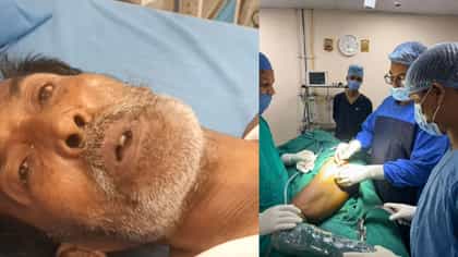আয়ুষ্মান ভারতের কামাল, দেড় লাখের অপারেশন হয়ে গেল সম্পূর্ণ ফ্রি-তে!