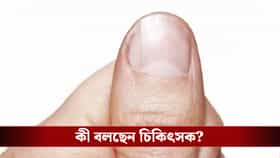 নখের সাদা চাঁদ কি কোনও বড় অসুখের ইঙ্গিত? এড়িয়ে যাওয়ার ভুল করবেন না
