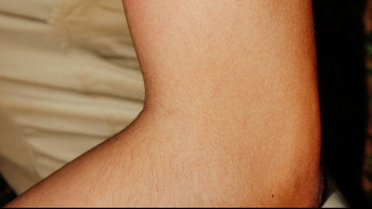 কনুইয়ের Ulnar Nerve হাতের নিচের অংশ ও কয়েকটি আঙুলের সেন্সের সঙ্গে যুক্ত। তাই কনুইয়ে আঘাত লাগার পর শুধু কনুইতেই নয়, হাতের নিচের অংশেও ঝিনঝিন বা শিরশির অনুভূতি হতে পারে। বিশেষ করে কনিষ্ঠা ও অনামিকা আঙুলে এই অনুভূতি বেশি টের পাওয়া যায়। অনেক সময় কয়েক মুহূর্তের মধ্যে এই অস্বস্তি নিজে থেকেই কমে যায়। (Credit- Unsplash)