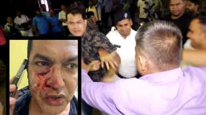 মুখ ফেটে বেরচ্ছে রক্ত, থানার সামনেই মারধরের অভিযোগ হুমায়ুনের