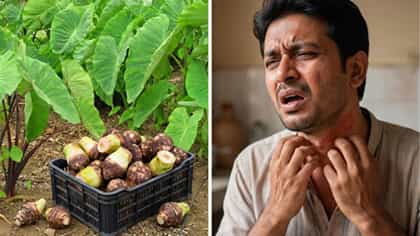লেবু, তেঁতুল নয়! কচু খেয়ে গলা চুলকালে ঝটপট কীভাবে মিলবে স্বস্তি?