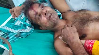 প্রমোটারের দাদাগিরি! ১৬ লক্ষ টাকা না পেয়ে জমির মালিককে রড দিয়ে মার