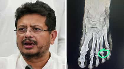 তাড়াহুড়ো করতে গিয়ে বড় চোট পেলেন ঋতব্রত
