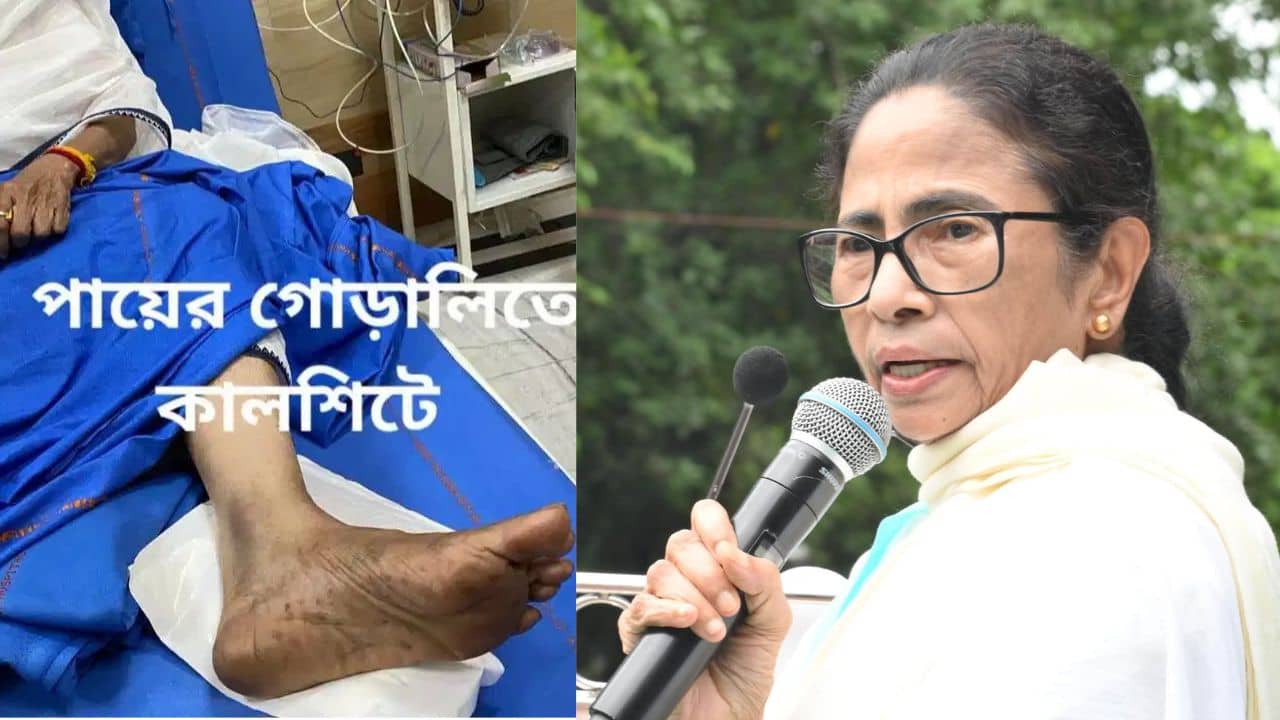 Mamata sent Legal notice:ব্যক্তিগত রিপোর্ট কীভাবে প্রকাশ্যে আনা হল? পায়ের আঘাত নিয়ে নোটিস পাঠালেন মমতা