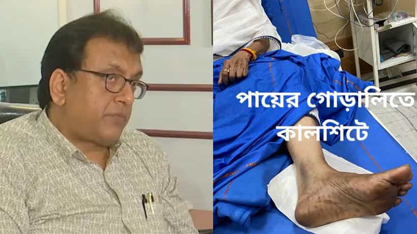Santanu Sen: গোড়ালিতে কালশিটের দাগ ছিল, রক্ত নয়! হাড়ে চোট না থাকা সত্ত্বেও প্লাস্টার, মমতার পা ভাঙা বিতর্কে এবার বিস্ফোরক দাবি শান্তনু সেনের