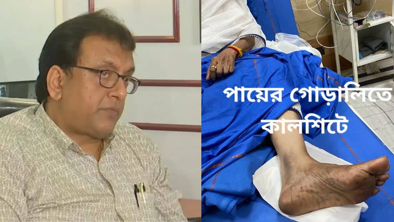 Santanu Sen: গোড়ালিতে কালশিটের দাগ ছিল, রক্ত নয়! হাড়ে চোট না থাকা সত্ত্বেও প্লাস্টার, মমতার পা ভাঙা বিতর্কে এবার বিস্ফোরক দাবি শান্তনু সেনের