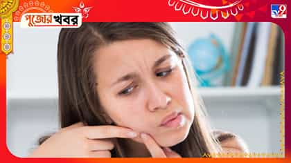পুজোর দিনে হঠাৎ মুখে ব্রণ? খোঁটাখুঁটি কান্নাকাটি না করে এটা করুন