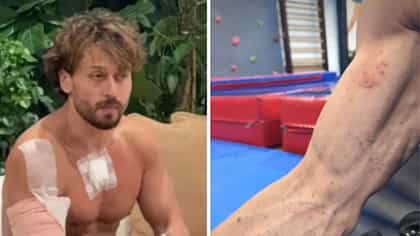 হাতে লাল লাল ছোপ! টাইগারের অবস্থা দেখে শিউরে উঠছেন ভক্তরা